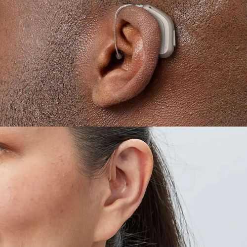 Oticon Intent 1 miniRITE Rechargeable Hearing aid - HearUpUSA